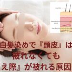 白髪染めで『頭皮』は被れなくても、『生え際』が被れる原因とは